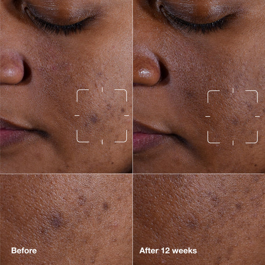 Clinique serum pump detail highlighting easy dispensing and controlled use