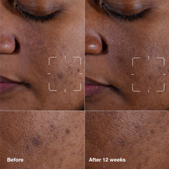 Clinique serum pump detail highlighting easy dispensing and controlled use