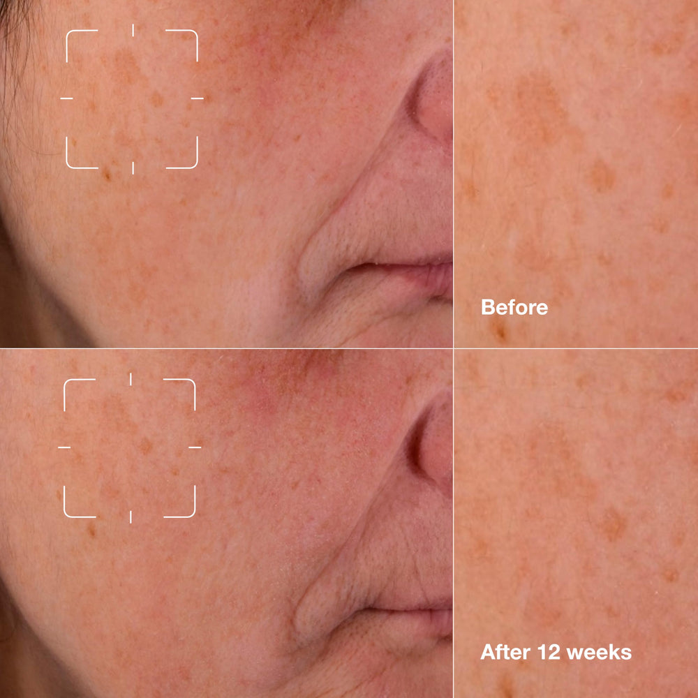 Clinique Even Better Clinical serum texture close-up offering lightweight feel