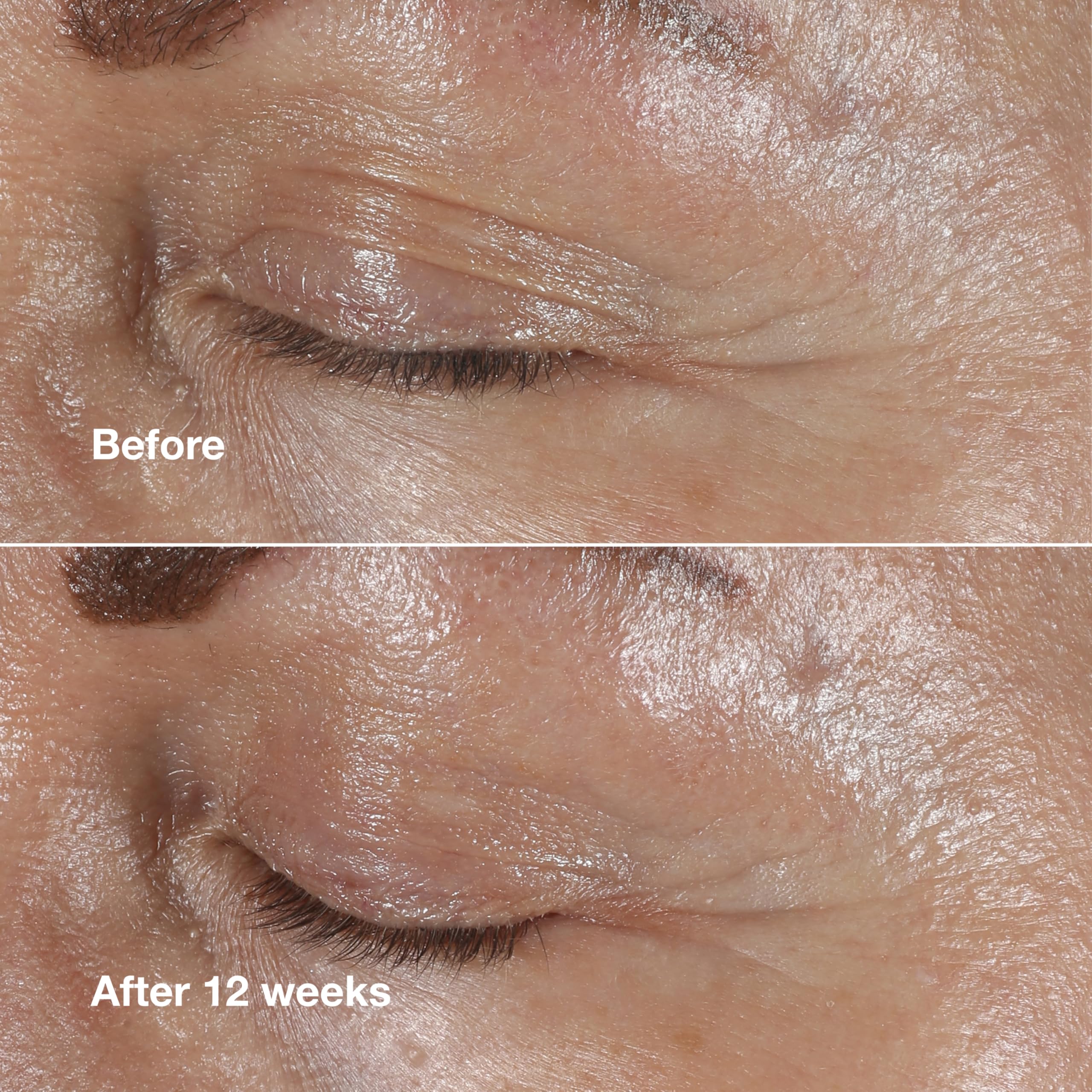 Clinique peptides ingredient visual communicating fortifying benefits for skin
