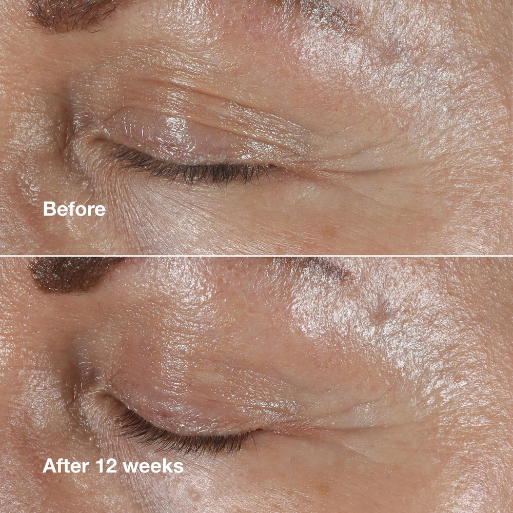 Clinique peptides ingredient visual communicating fortifying benefits for skin