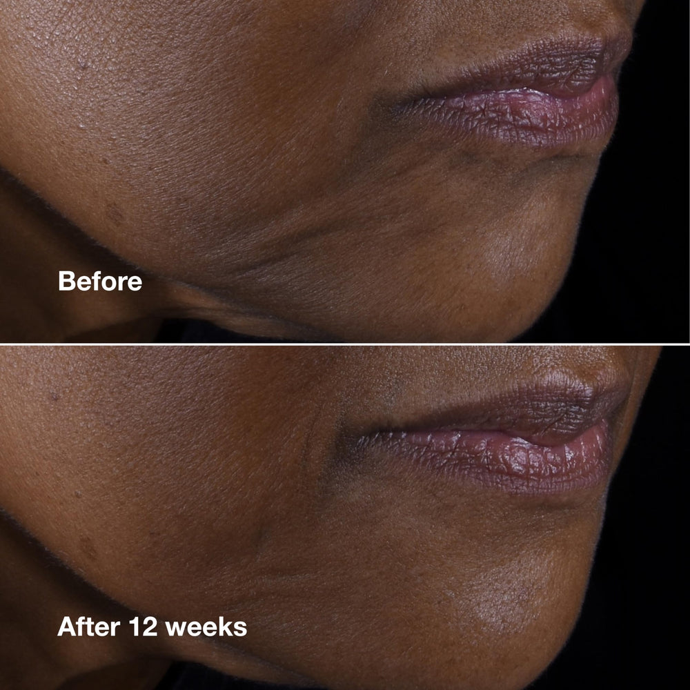 Clinique ingredient visual with hyaluronic acid and peptides for support