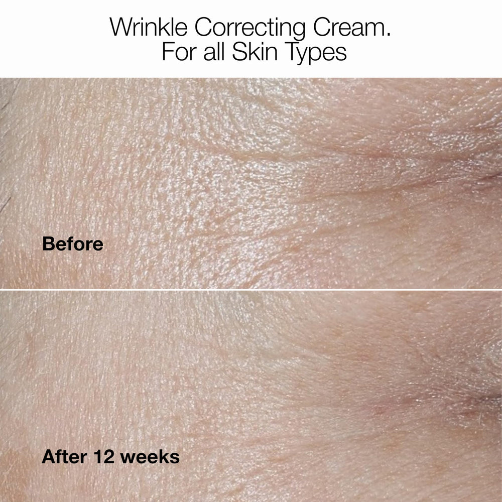 Clinique open jar top view revealing creamy formula ready for application