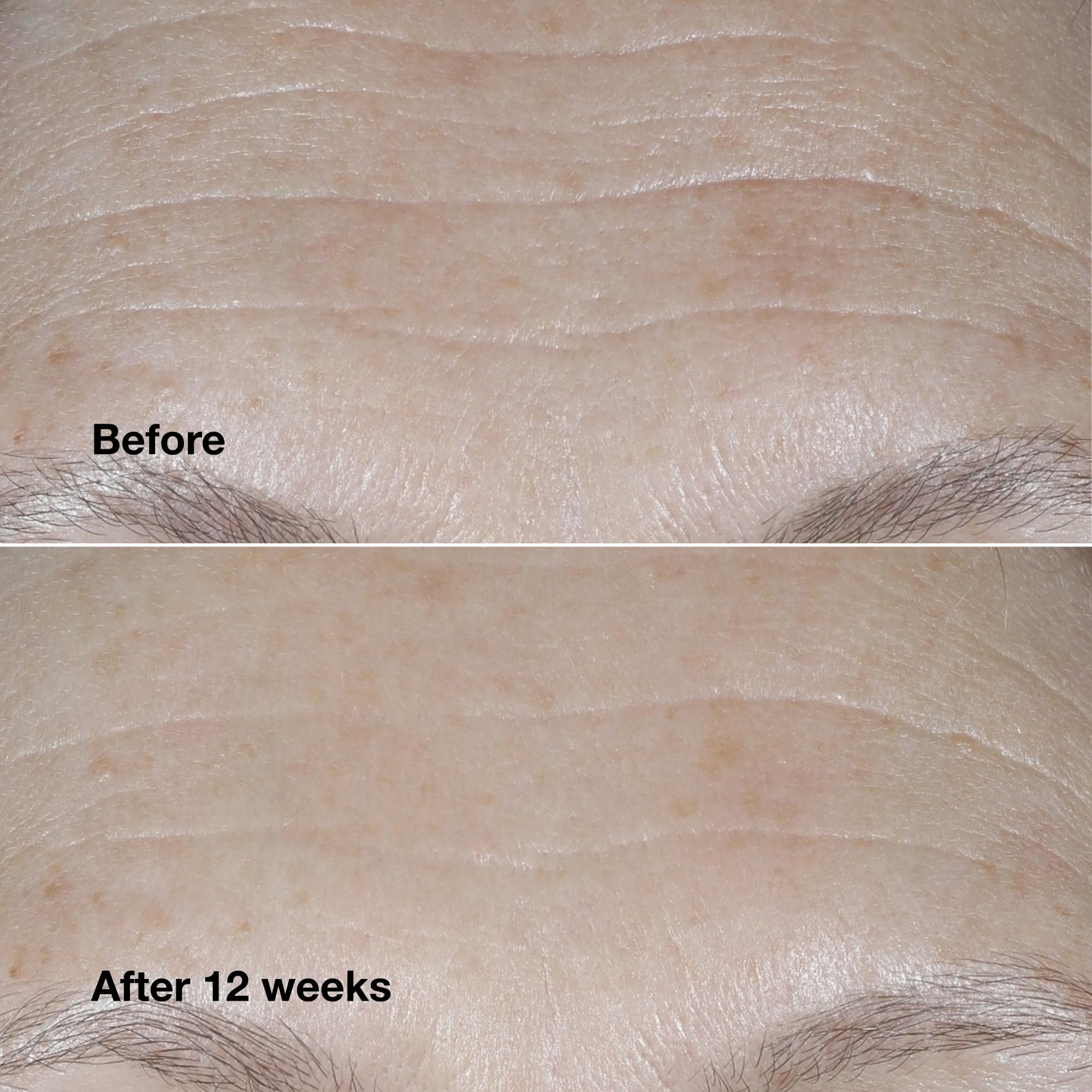 Clinique product label highlighting peptides and hyaluronic acid for repair