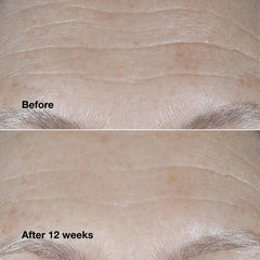 Clinique product label highlighting peptides and hyaluronic acid for repair