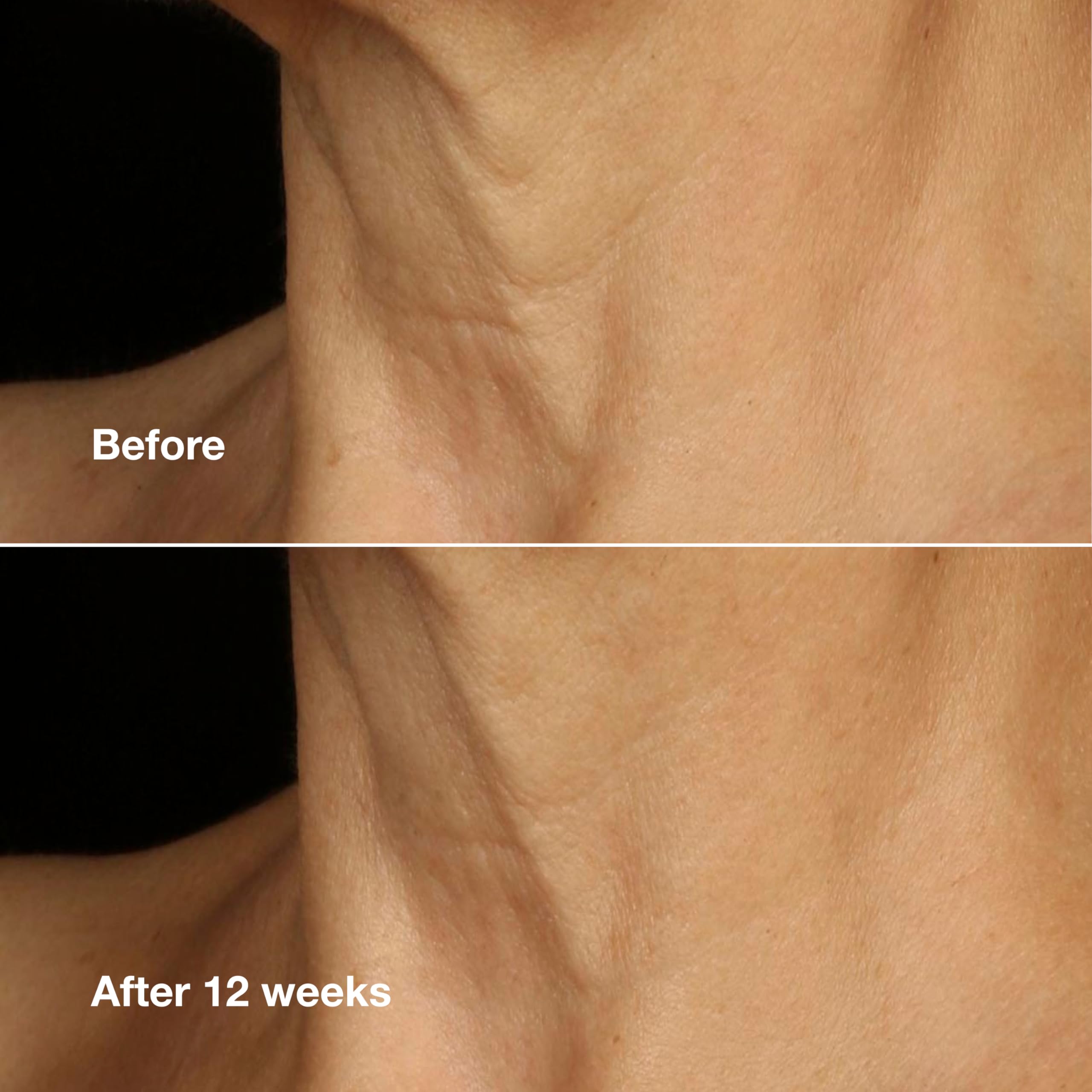Clinique applying cream to neck showing lifting and smoothing effect