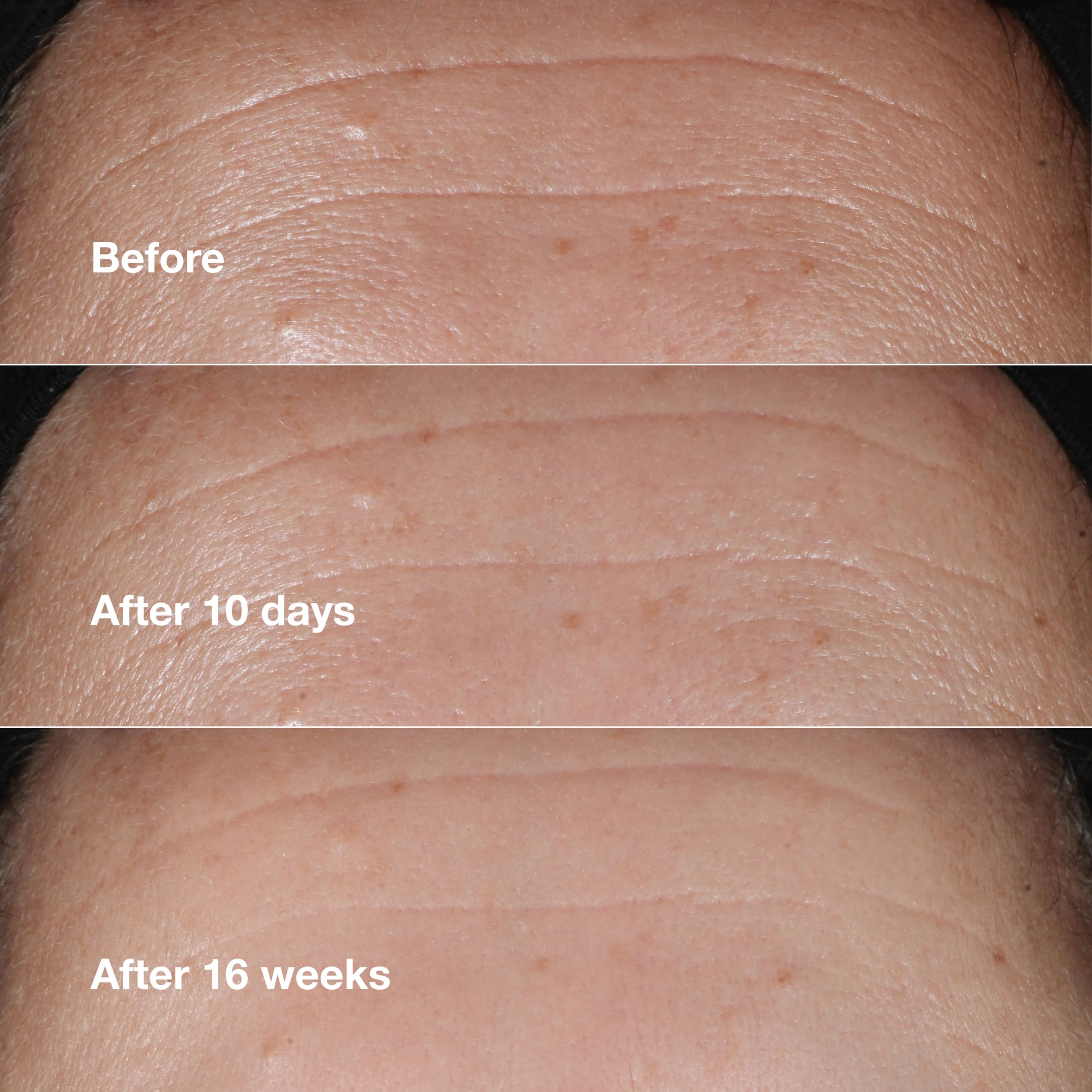 Clinique serum droplets on skin showing hydration and instant smoothing effect