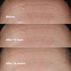 Clinique serum droplets on skin showing hydration and instant smoothing effect