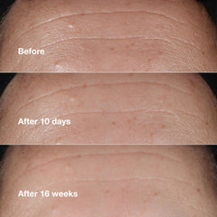 Clinique Smart Clinical Repair 1.7 fl oz with outer box for clear product identification and trust