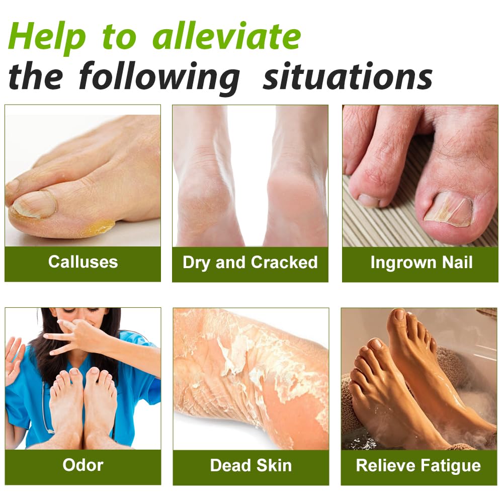 closewave before and after callus care demonstrating visible smoothing