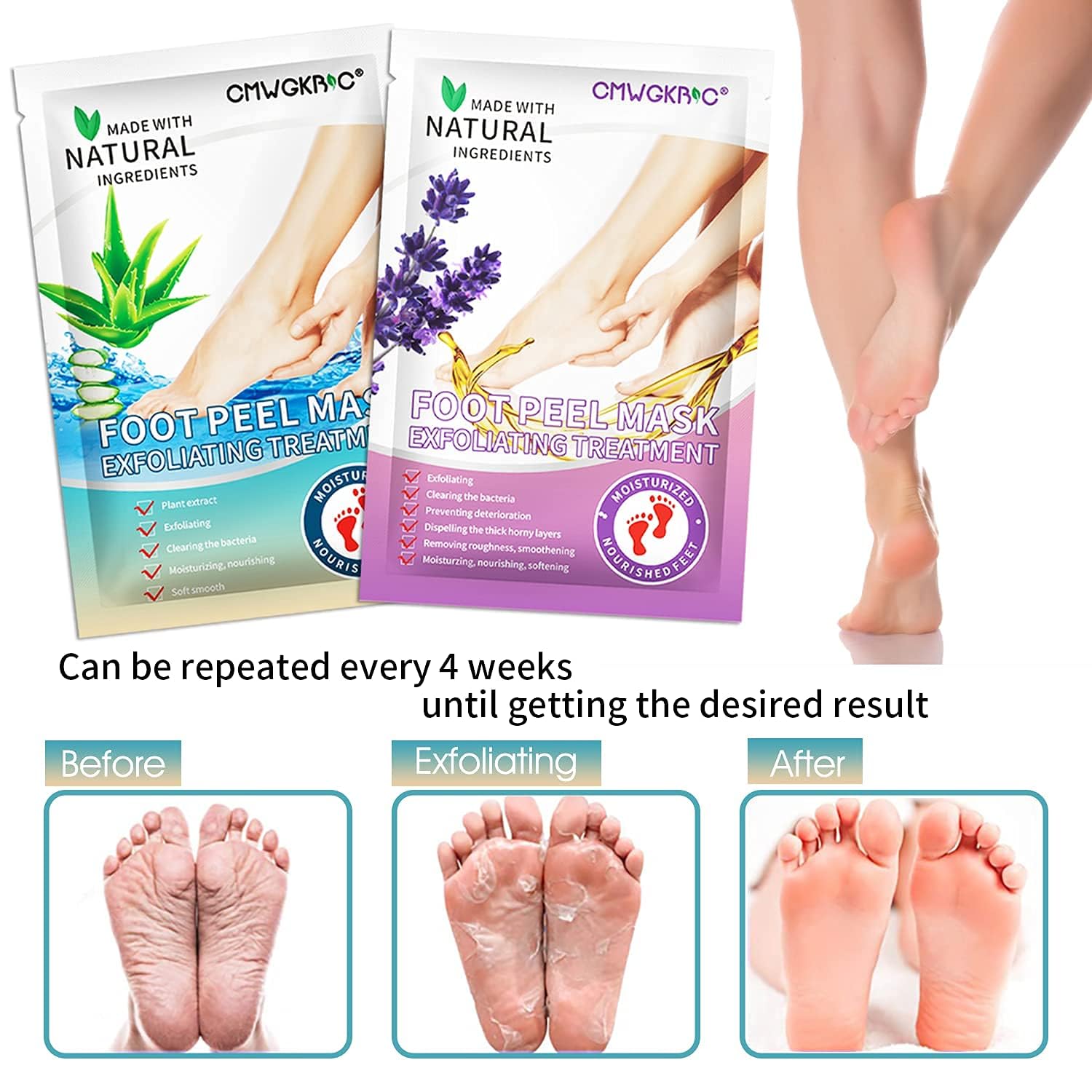 CMWGKBC before and after feet comparison showing softer heels after peel