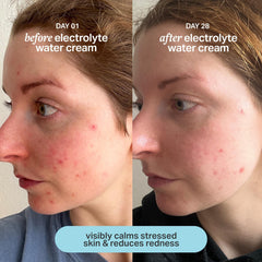 Cocokind cream spread on hand demonstrating quick absorption