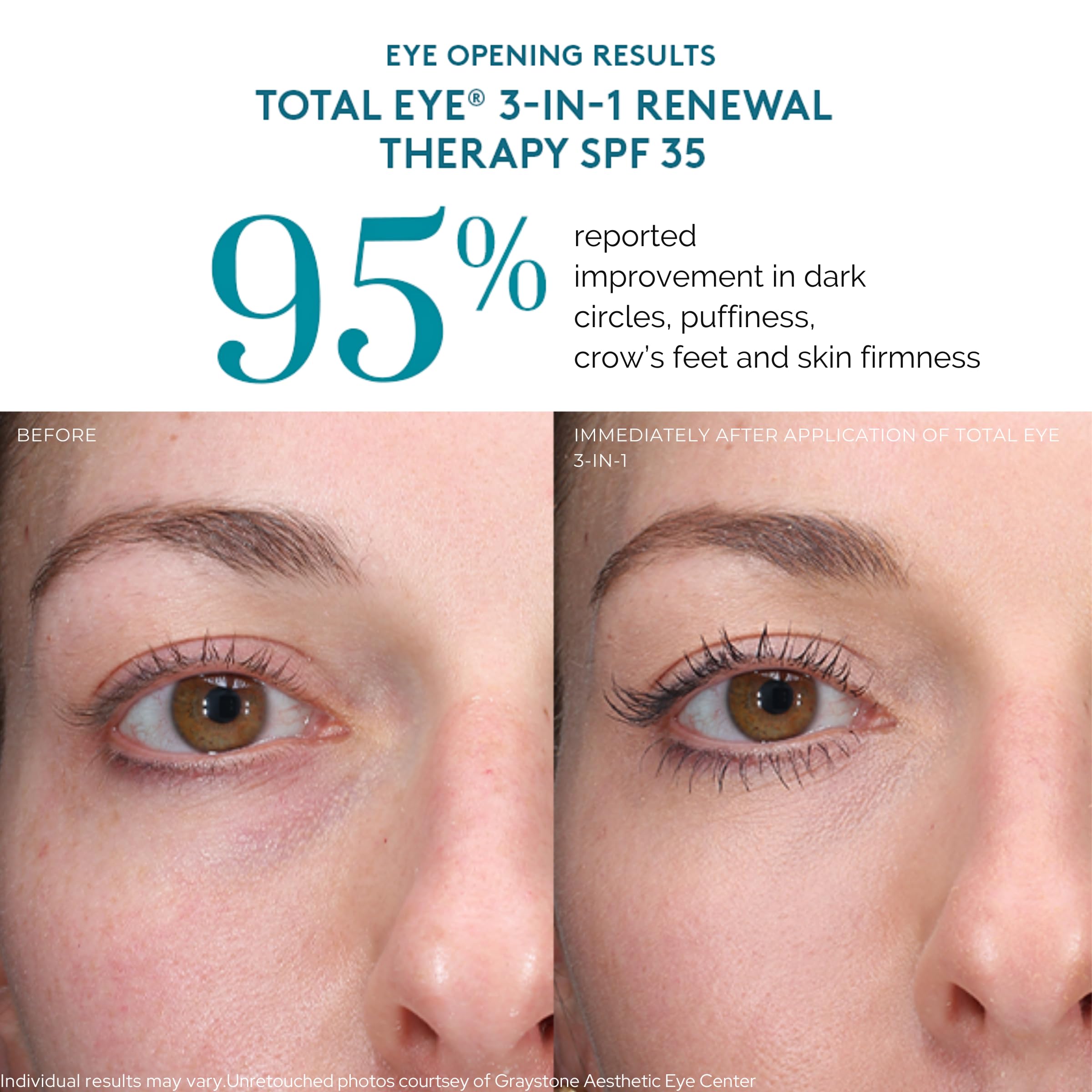 Colorescience Total Eye in makeup bag lifestyle scene for everyday use benefits