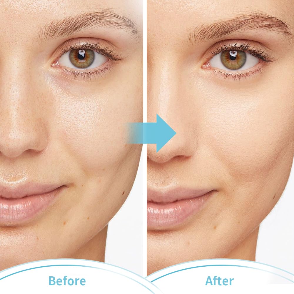 CONBELLA used in a lifestyle scene to reduce facial tension