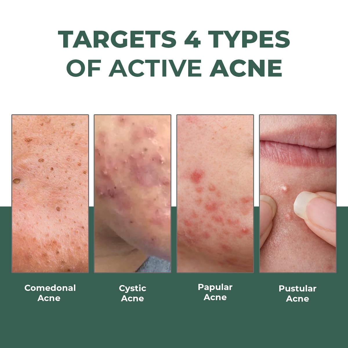 Conscious Chemist spot application on cheek demonstrating targeted treatment benefit
