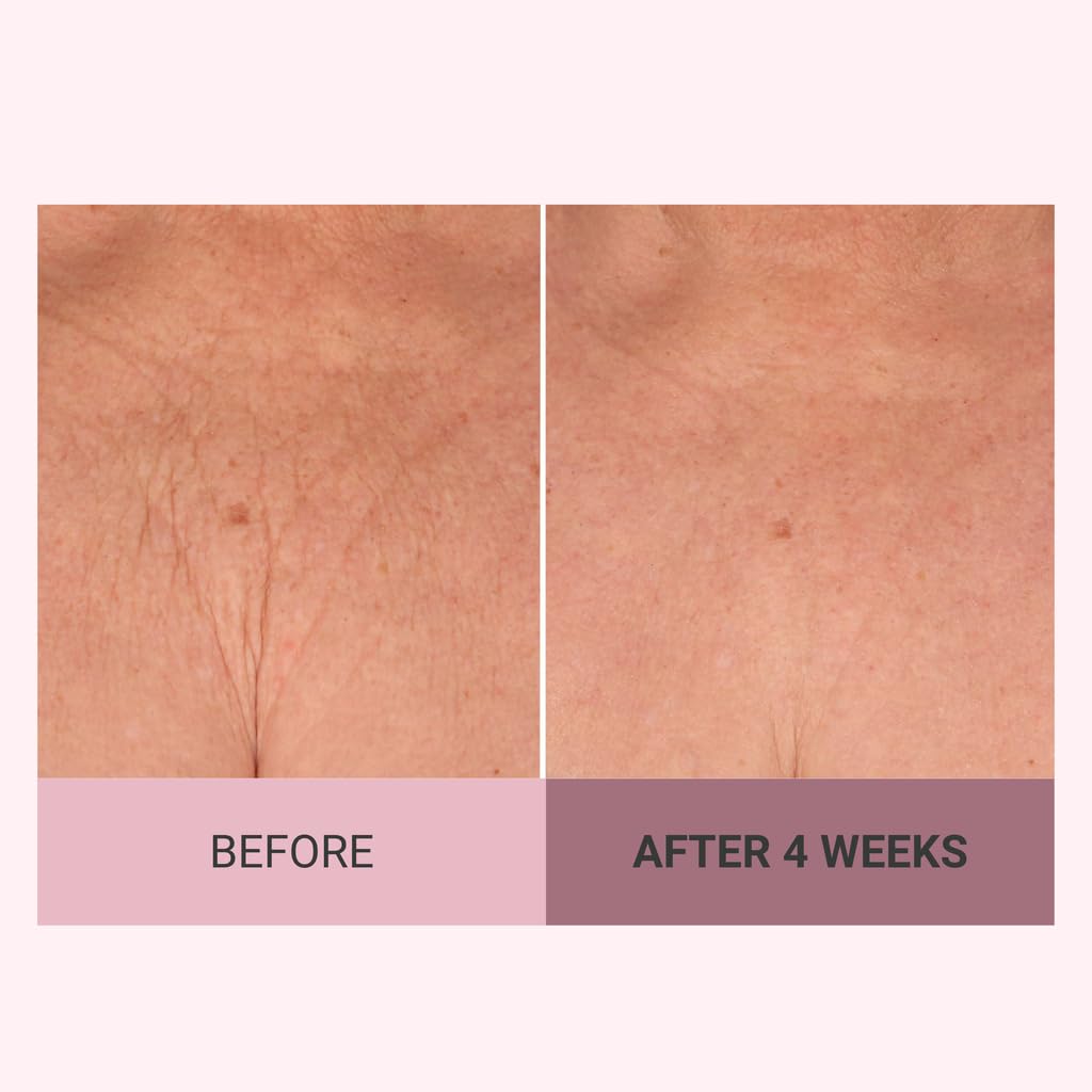 Consult Beaute cream being smoothed on forearm to show absorption and smoothing