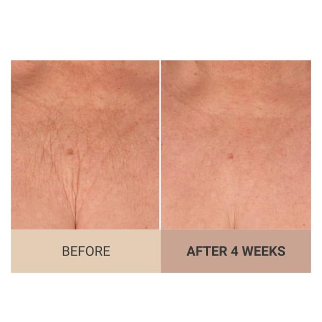 Consult Beaute jar angle showing label details and product benefit clarity