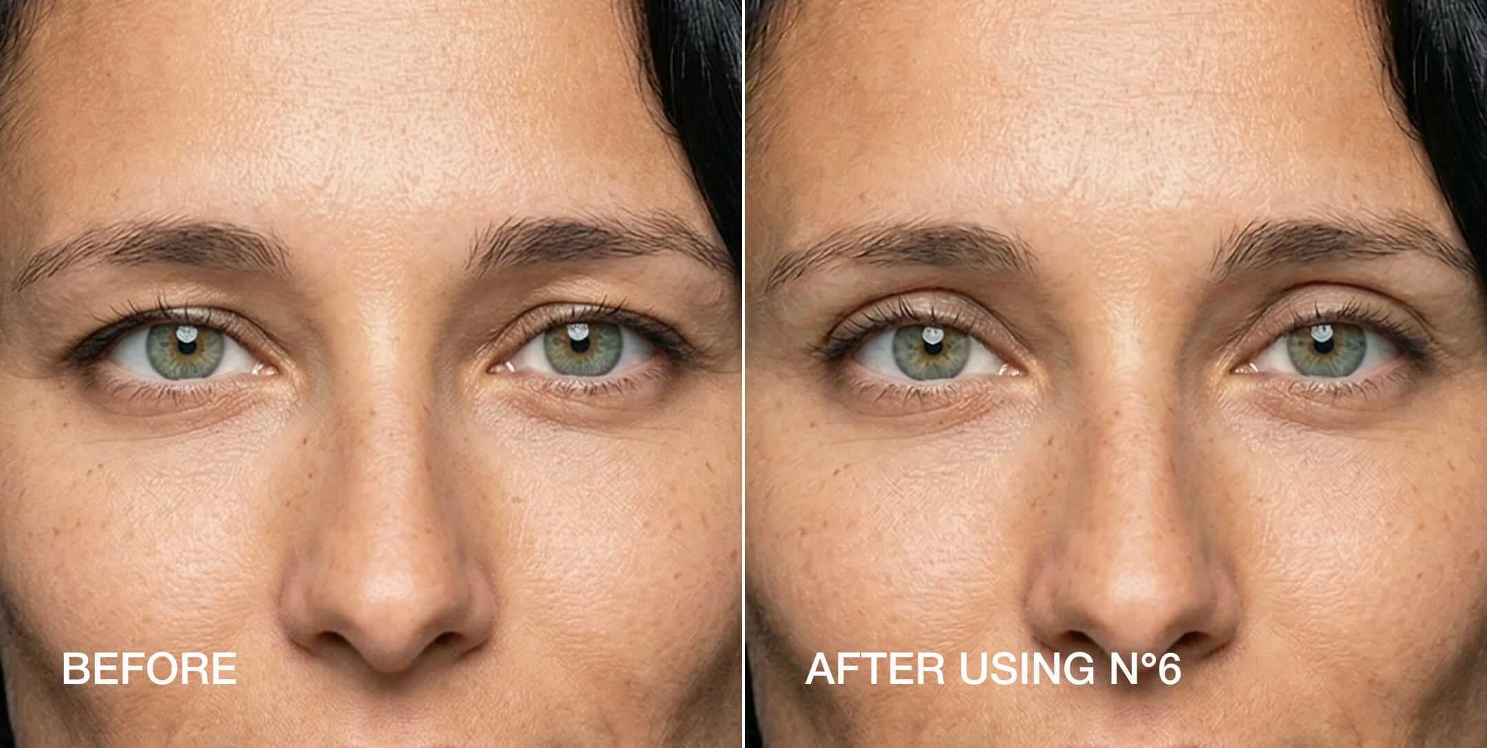 Contours Rx before and after comparison demonstrating visible lift