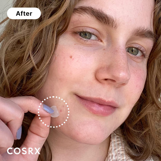 COSRX three sized patches displayed for versatile spot coverage