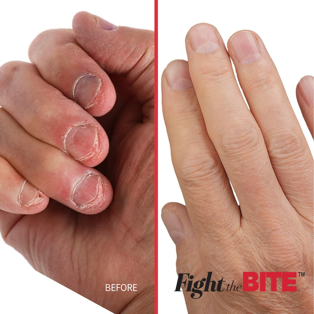 Cuccio application on natural nails demonstrating habit-deterrent effect