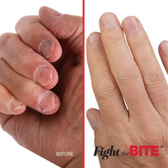 Cuccio application on natural nails demonstrating habit-deterrent effect
