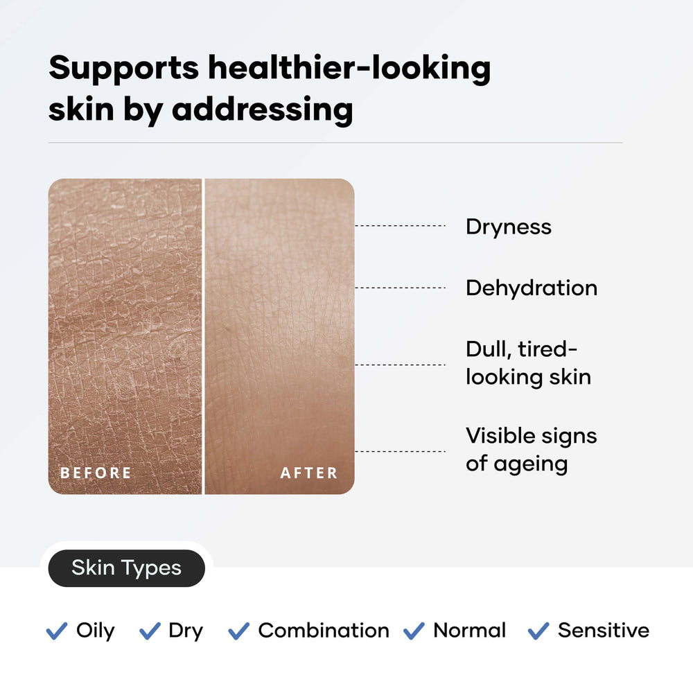 Cureskin size comparison with a coin illustrating the 1.76 ounce compact tube