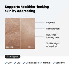 Cureskin size comparison with a coin illustrating the 1.76 ounce compact tube