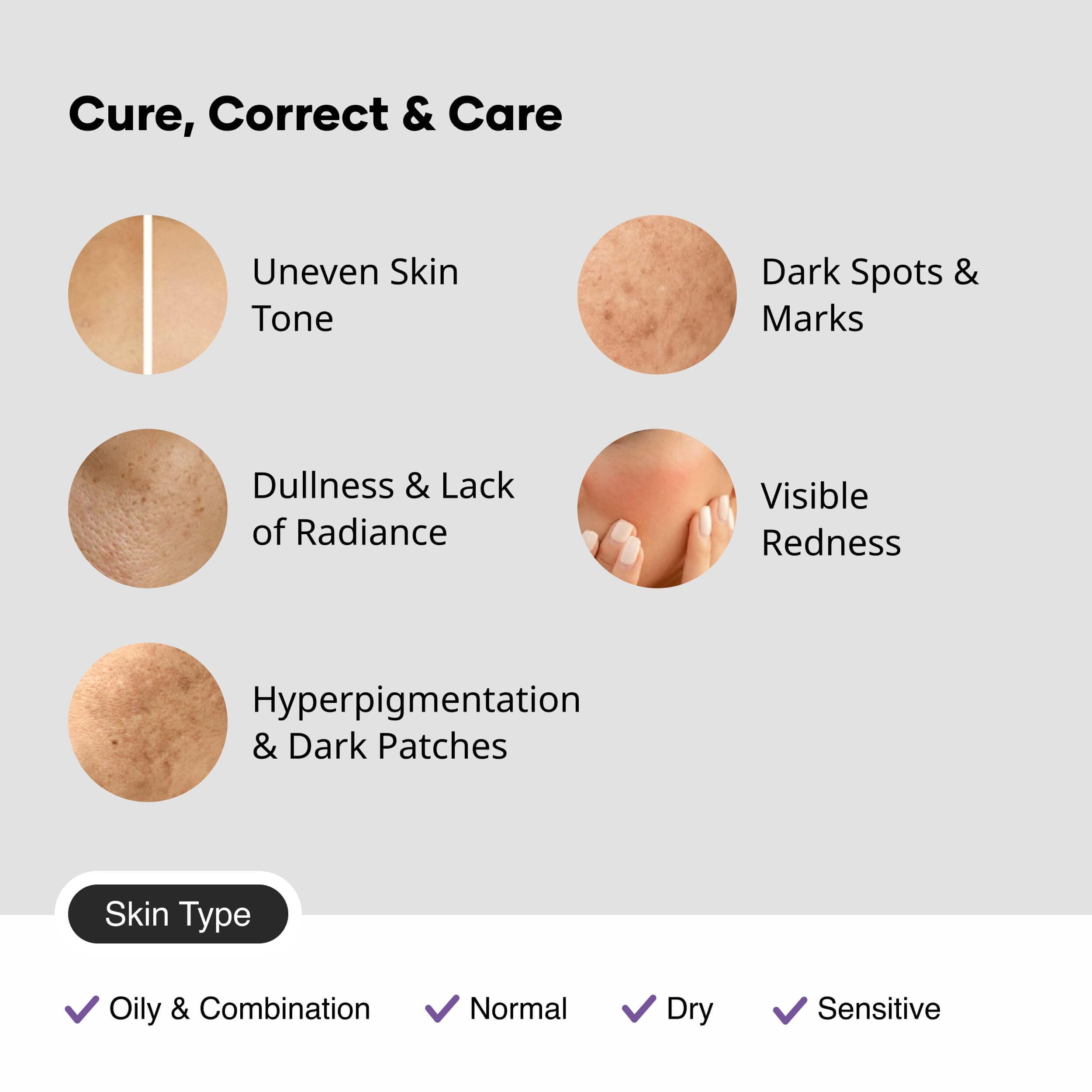 Cureskin 15g size scale with ruler showing compact travel-friendly convenience