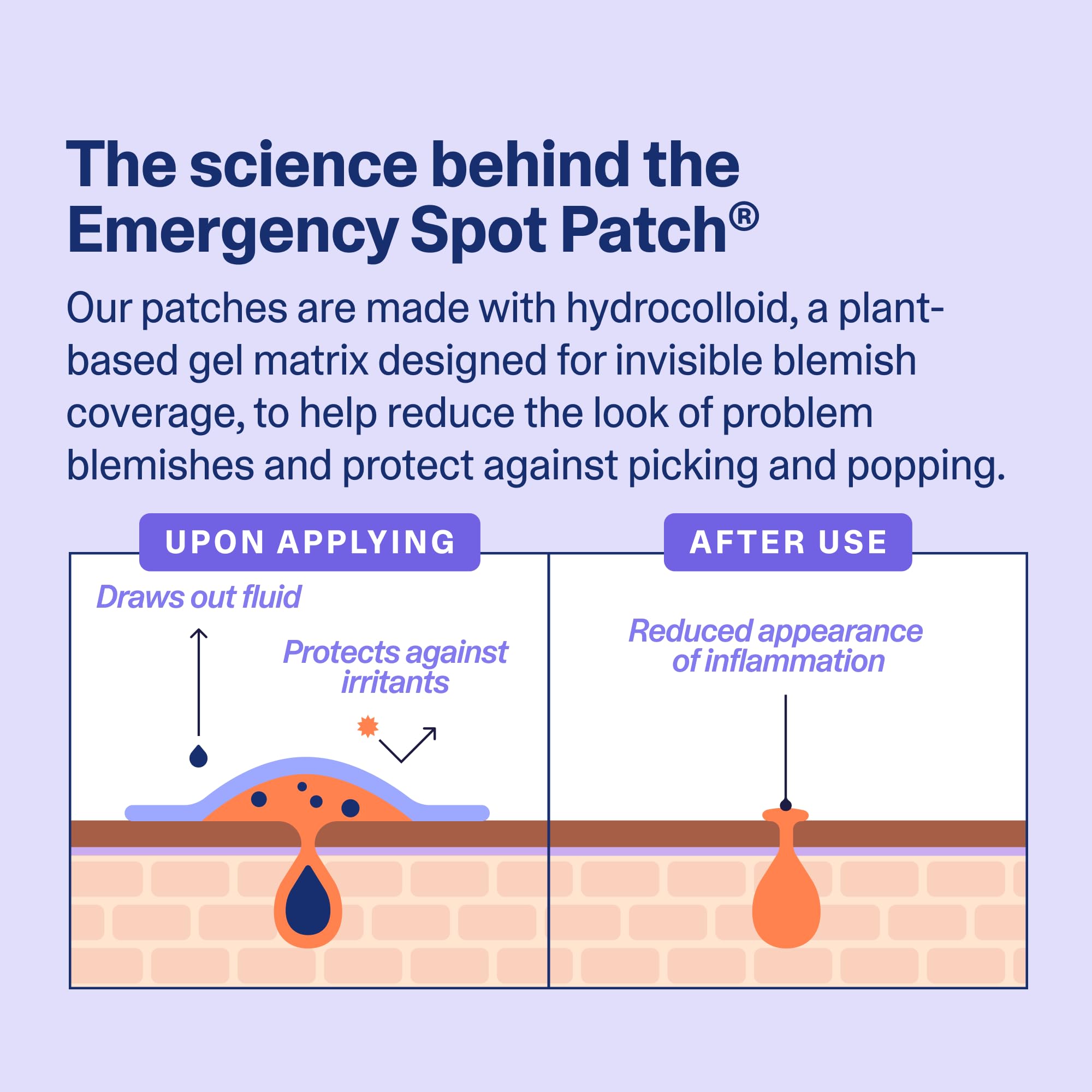 Curology patch under makeup demonstrating discreet coverage and confidence