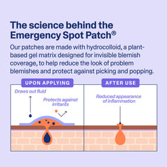 Curology patch under makeup demonstrating discreet coverage and confidence