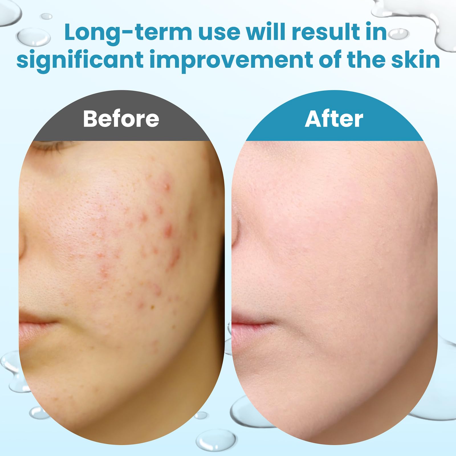 Dalin ingredient label highlighting vitamins B3 C E and acids for antioxidant support benefit