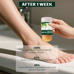 Danliss applied to heel showing targeted callus treatment benefit