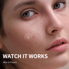 Daolyo patches worn overnight on face showing comfortable, secure wear
