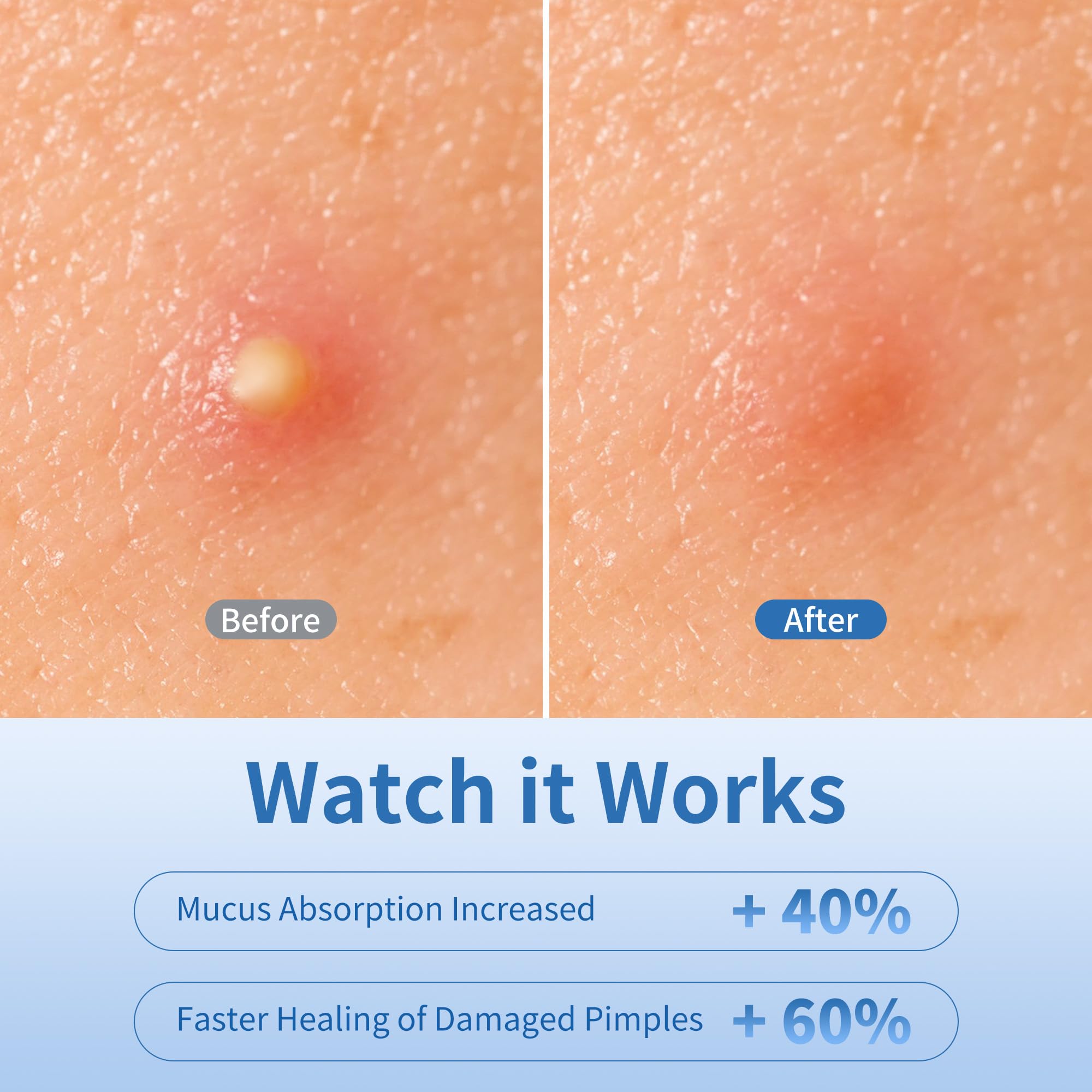 Daolyo star patch on cheek protecting blemish during day