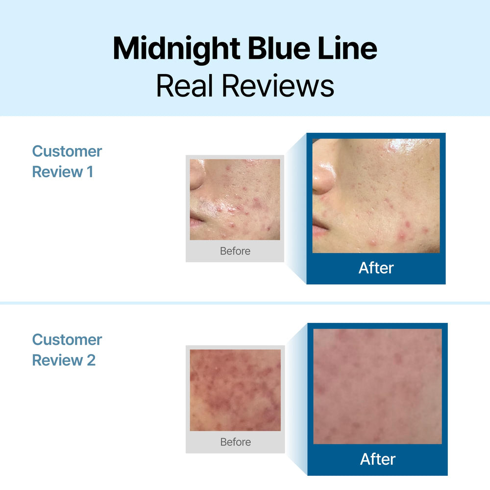 DearKlairs applied after professional treatment to comfort heated skin
