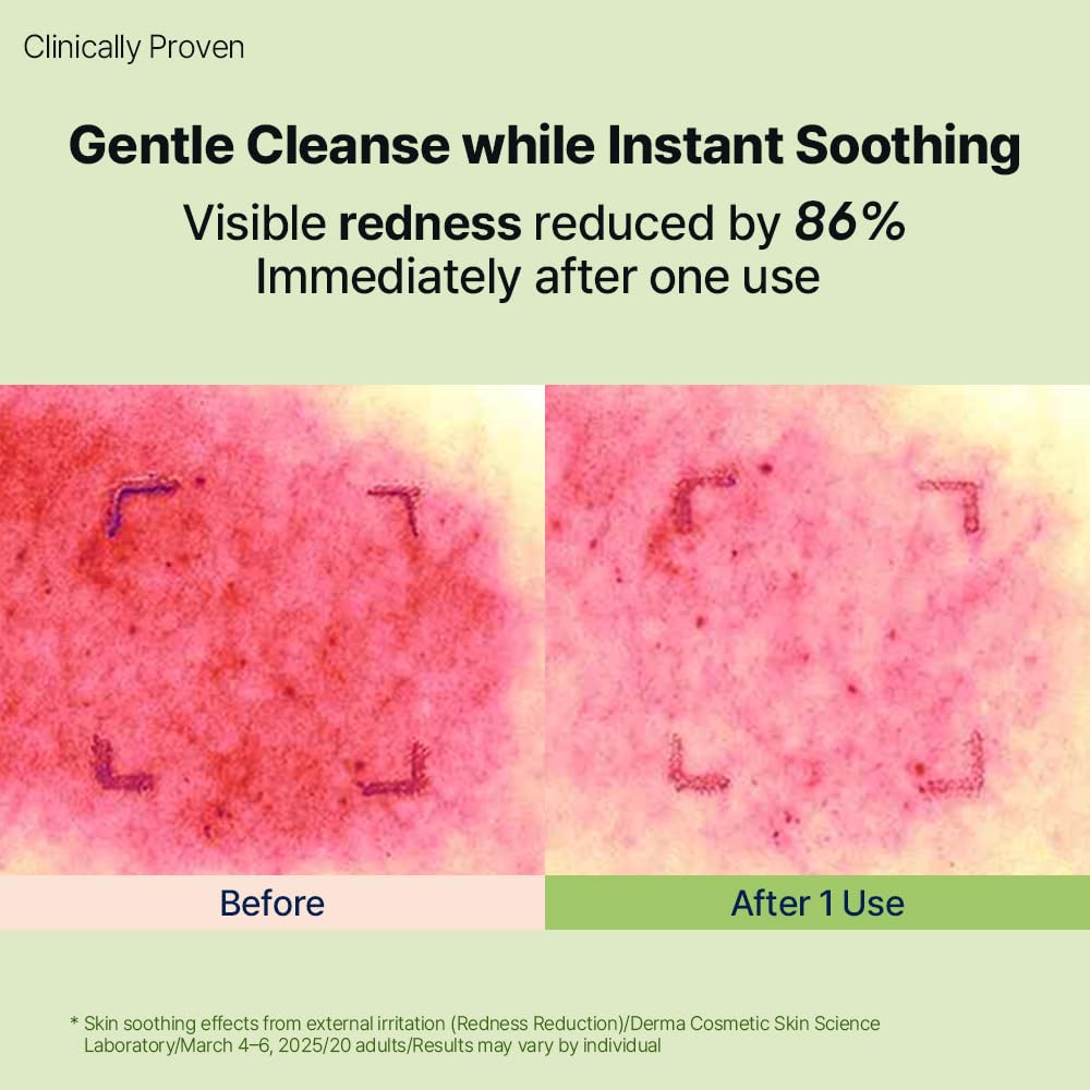 DearMYDEW foam being applied to face showing mild, non-irritating cleanse