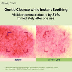 DearMYDEW foam being applied to face showing mild, non-irritating cleanse