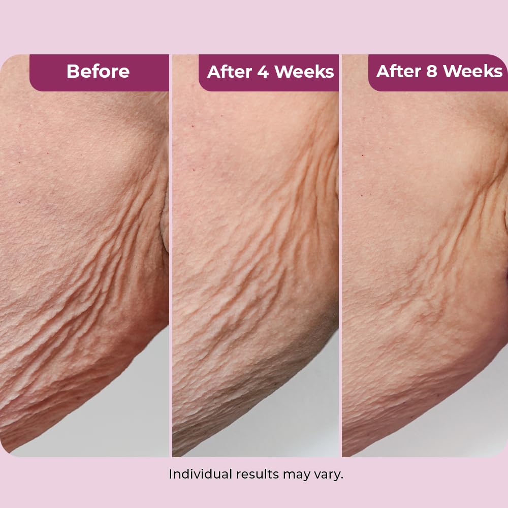 DEKLIDERM being applied to neck to visibly smooth and firm skin
