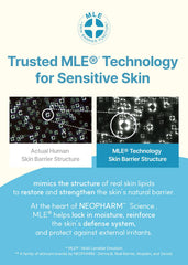 Derma B smoothing over elbow and knee showing improved skin softness benefit