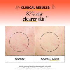 Derma E cleanser foamy texture close-up for gentle exfoliation benefit