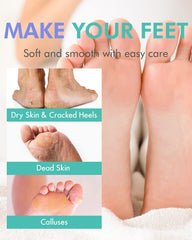 DERMAL feet mid-peel showing natural shedding, gradual softening and renewal