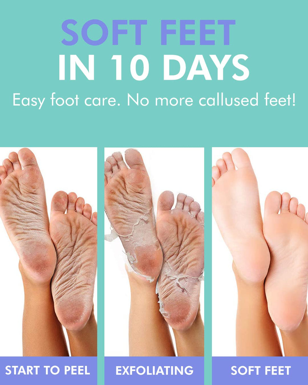 DERMAL sock mask fitted on foot, comfortable 60–90 minute treatment in use