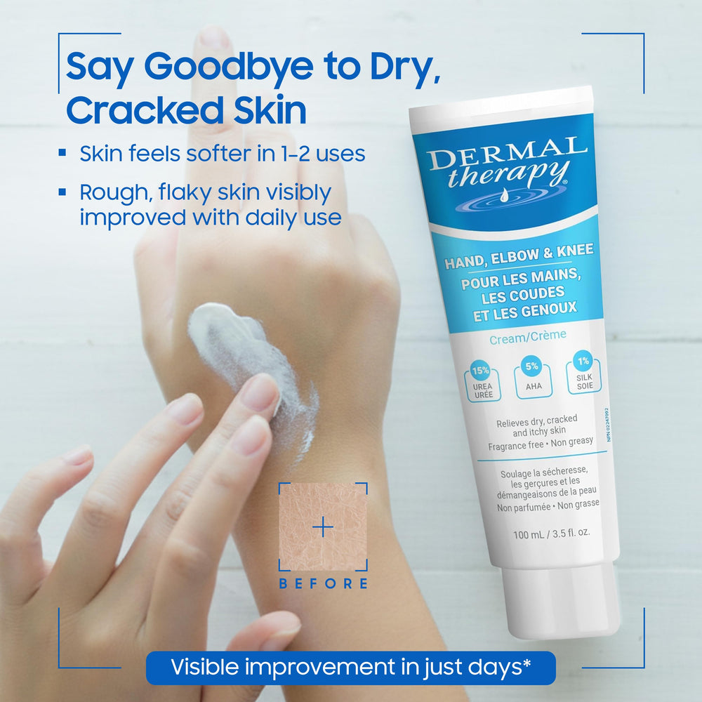 Dermal Therapy being applied to hands to deeply hydrate and soften rough skin