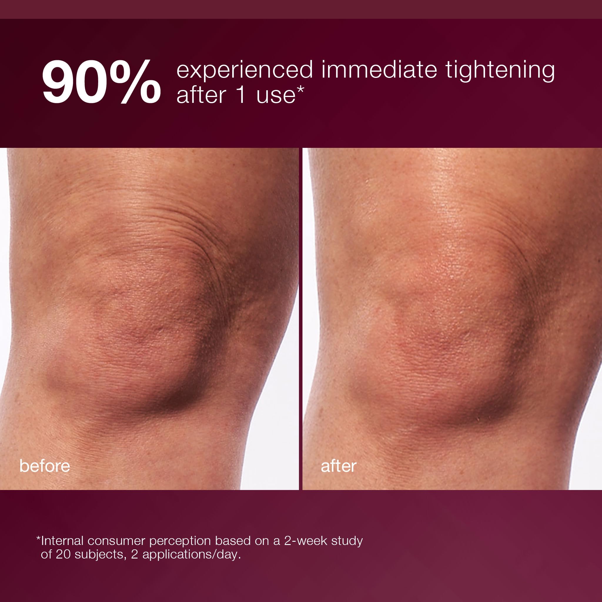 Dermalogica applying serum to arms for visible toning and smoothness