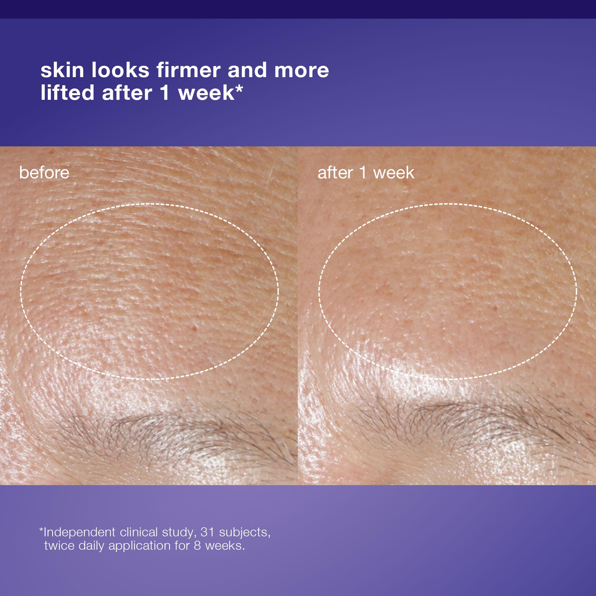 Dermalogica cream applied on hand, demonstrates spreadability and non-greasy feel