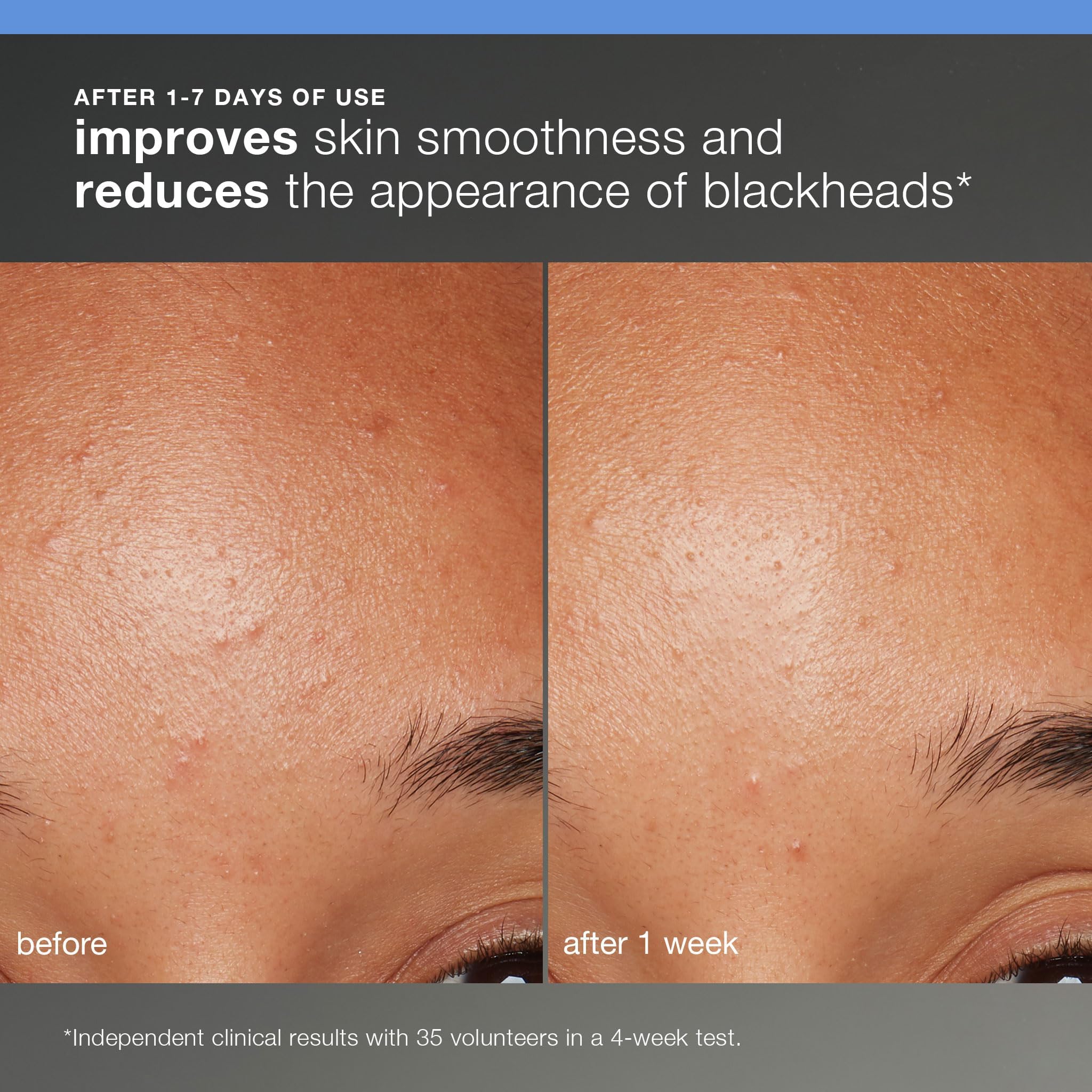 Dermalogica Skin Smoothing Cream texture swirled to show lightweight hydration