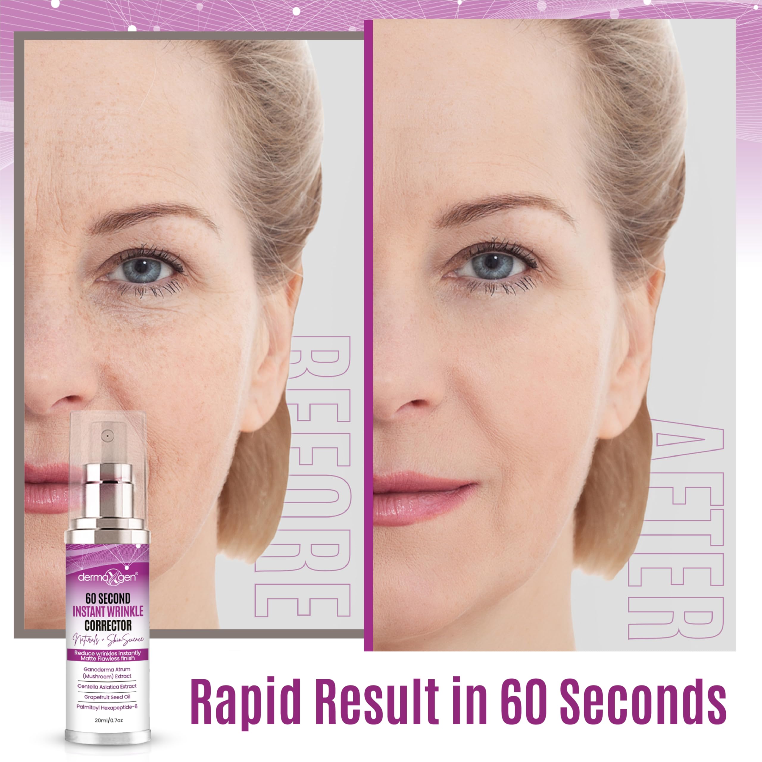 DERMAXGEN applied around mouth corner to visibly soften expression lines benefit
