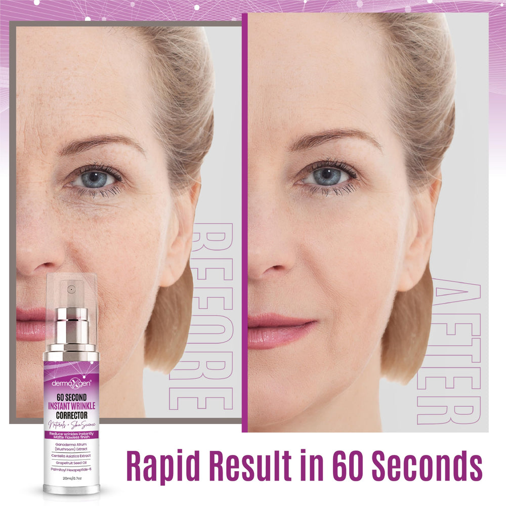 DERMAXGEN applied around mouth corner to visibly soften expression lines benefit
