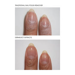 Dermelect wipe removing dark nail polish cleanly from a fingernail