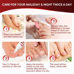 DERMFREE before and after nail comparison showing improved nail appearance